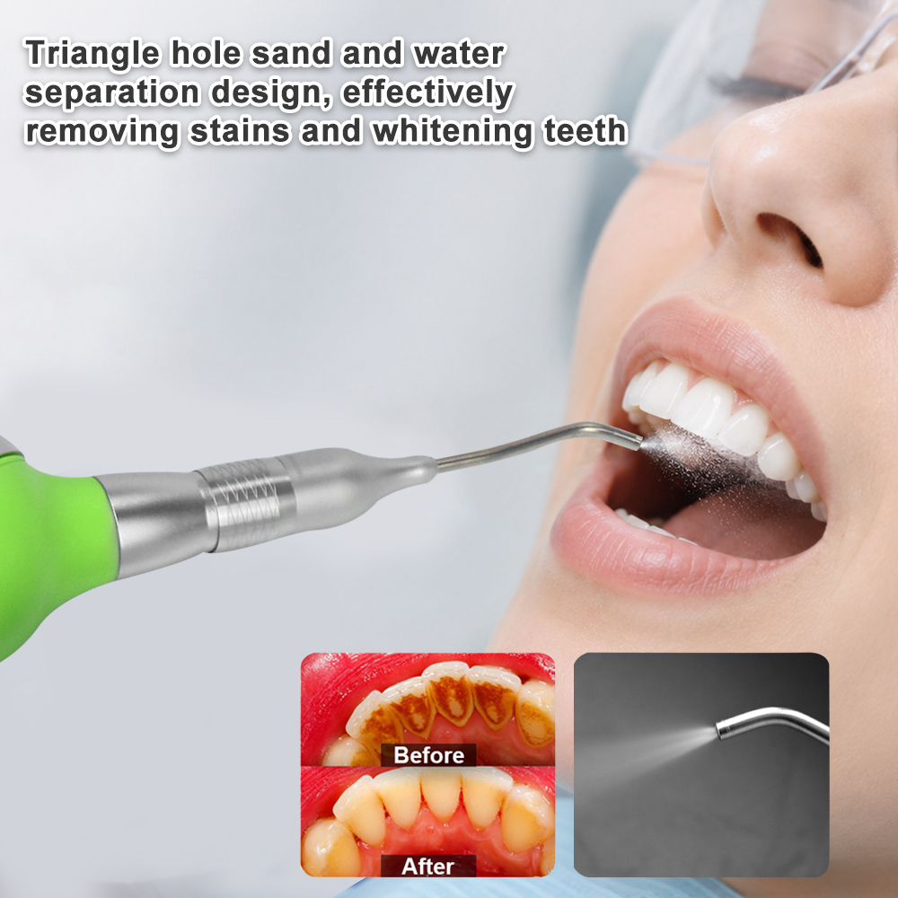 Dental Air Polisher With Anti- - огляд і ціна Teeth Whitening Options