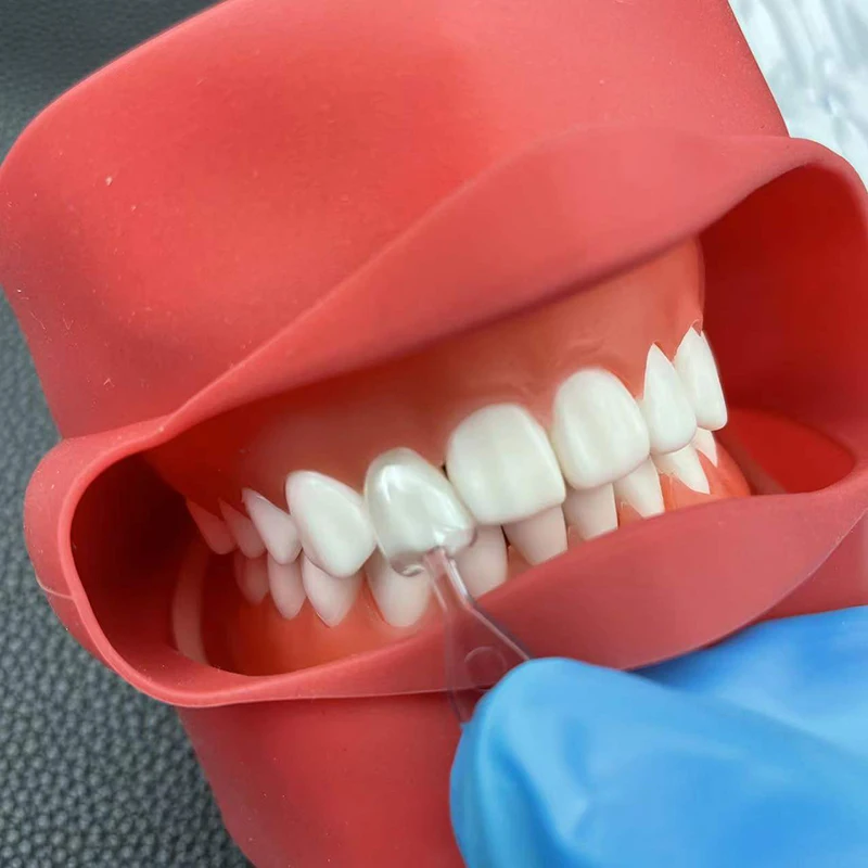 1Set/3Set/5Set Dental Veneer M - огляд і ціна Teeth Whitening Moulds