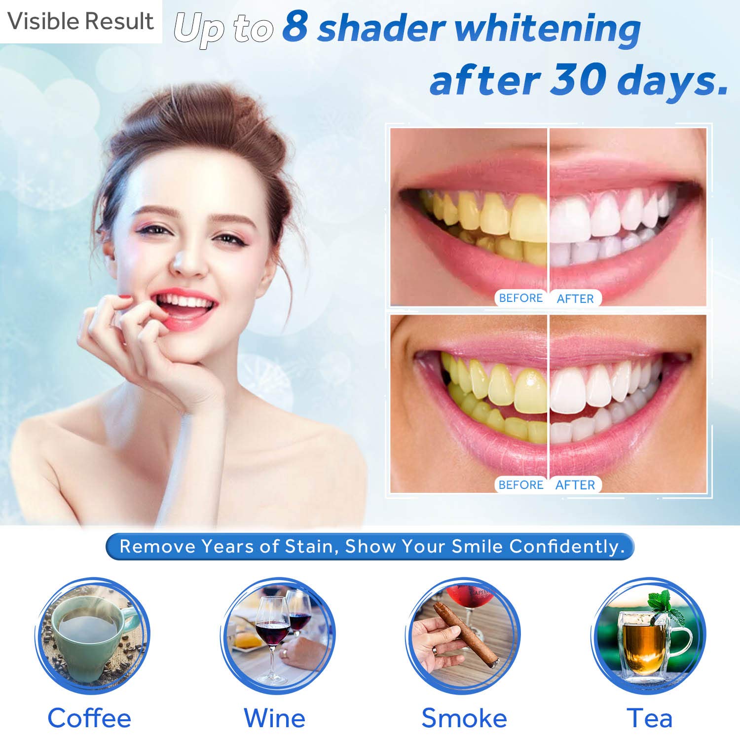 Teeth Whitening Gel Refill Syr - огляд і ціна Teeth Whitening Near Me