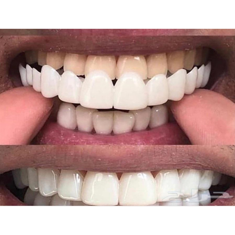 Soft Silicone Gel Dental Oral  - огляд і ціна Teeth Whitening Moulds