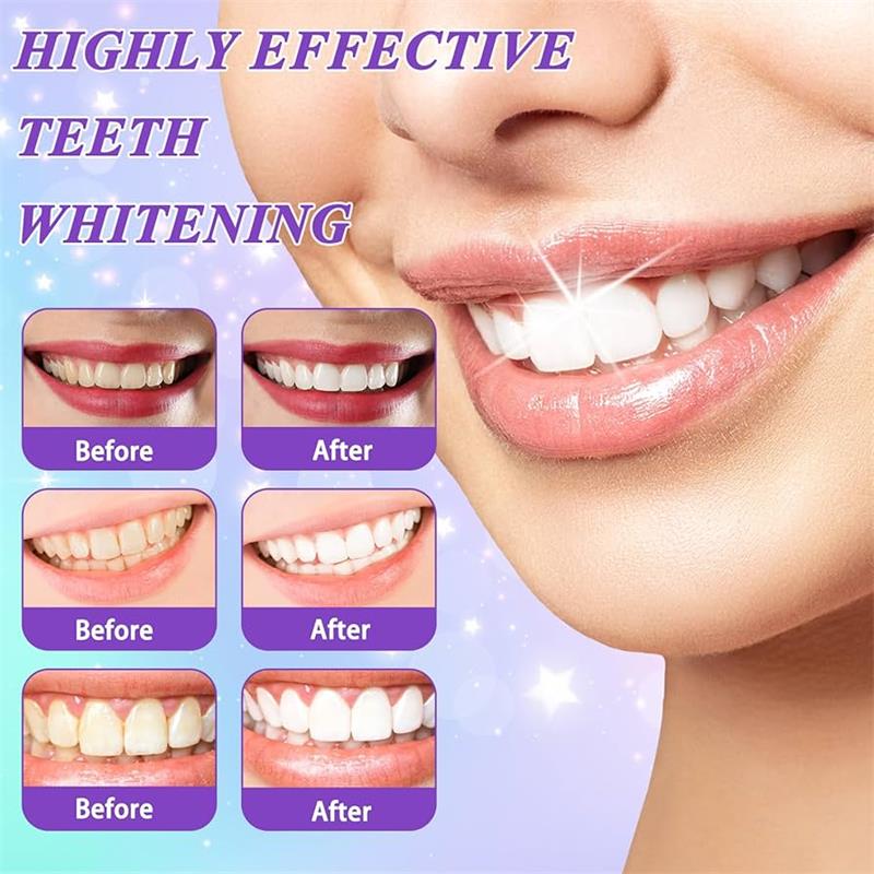 9D Purple Teeth Whitening Toot - огляд і ціна Remineralizing Toothpaste
