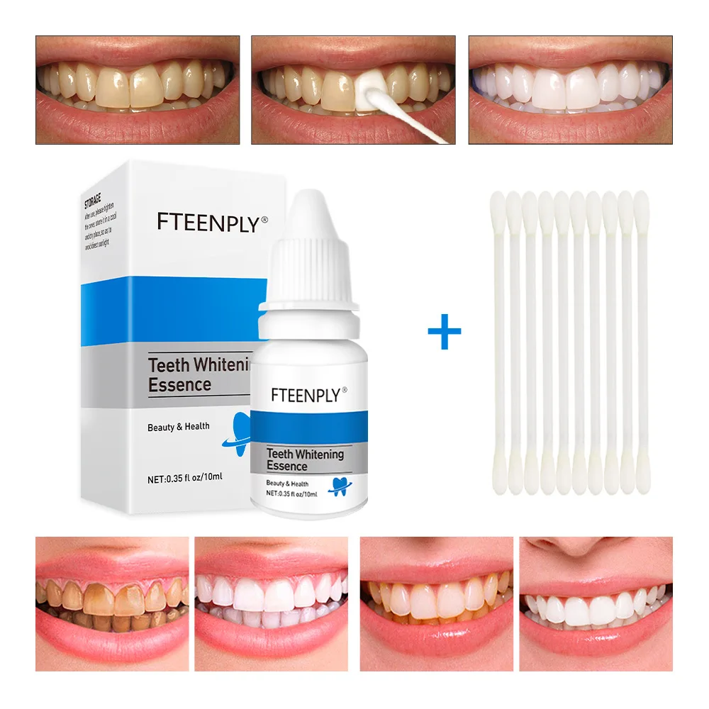 FTEENPLY Teeth Whitening Essen - огляд і ціна Teeth Whitening Near Me