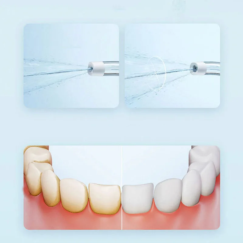 Xiaomi Portable Oral Irrigator - огляд і ціна Teeth Whitening Quick